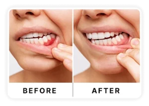 Benefits of DentaVive